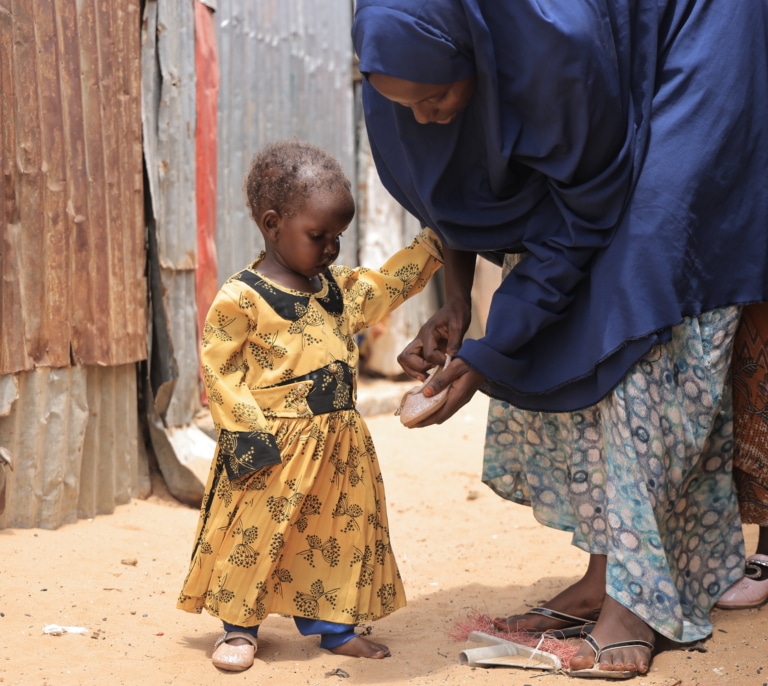 La crisis silenciosa de Somalia: cuando la ayuda llega tarde, los niños mueren