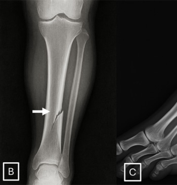 Las radiografías ‘deepfake’ hechas con ChatGPT engañan a radiólogos y a la [...]