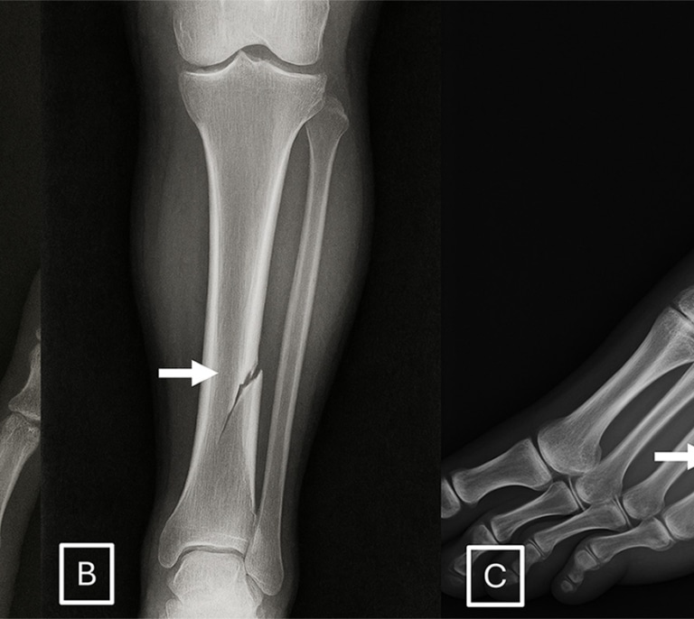 Las radiografías ‘deepfake’ hechas con ChatGPT engañan a radiólogos y a la propia IA