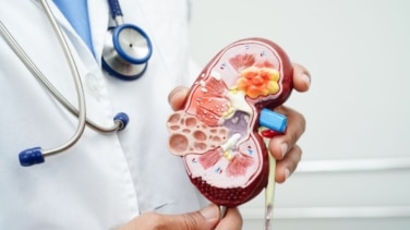 Los Hospitales de Quirónsalud integrados en el Sermas detectaron 424 nuevos casos de enfermedad renal crónica en 2025