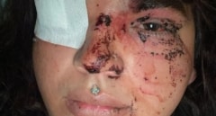 Detenidas cinco mujeres por la agresión a Miss Trans Zamora en La Bañeza