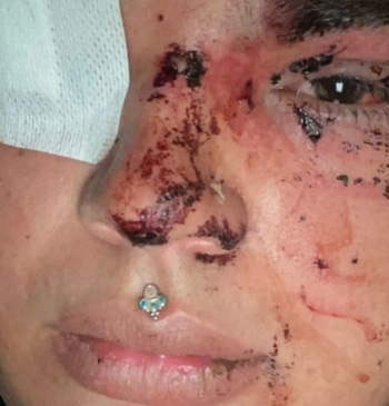 Detenidas cinco mujeres por la agresión a Miss Trans Zamora en La [...]