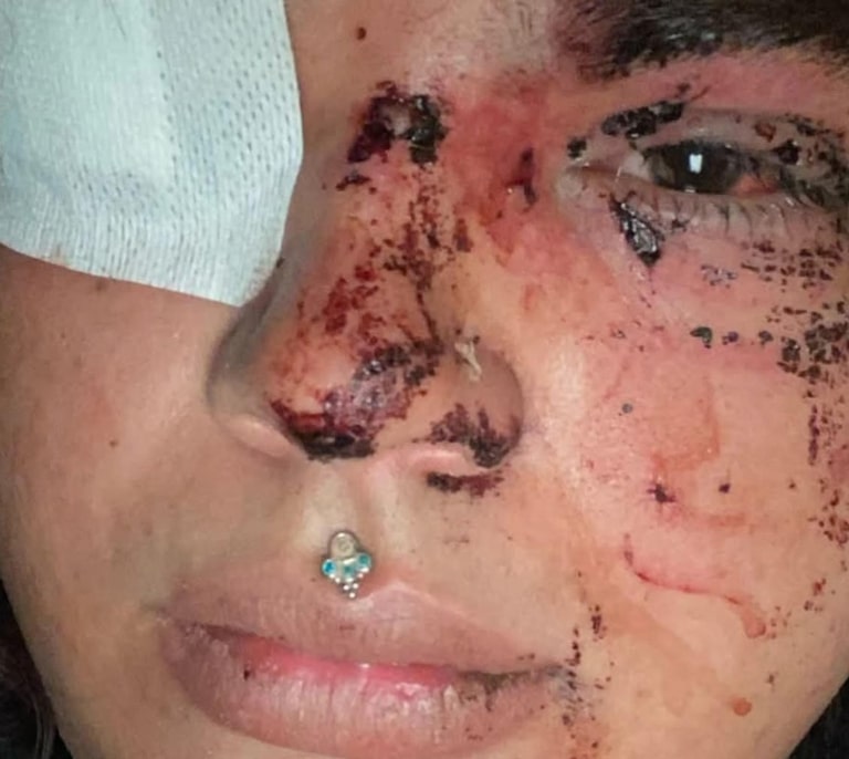 Detenidas cinco mujeres por la agresión a Miss Trans Zamora en La Bañeza