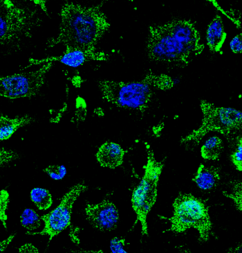 Un fármaco del CSIC que podría cambiar el curso de la ELA [...]