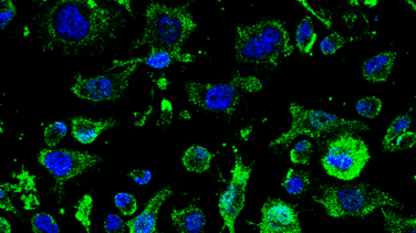 Un fármaco del CSIC que podría cambiar el curso de la ELA inicia su ensayo en humanos 
