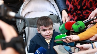 ¿Qué es la 'piel de mariposa'? La enfermedad rara que sufre Leo: "Sueño con vivir sin tanto dolor"