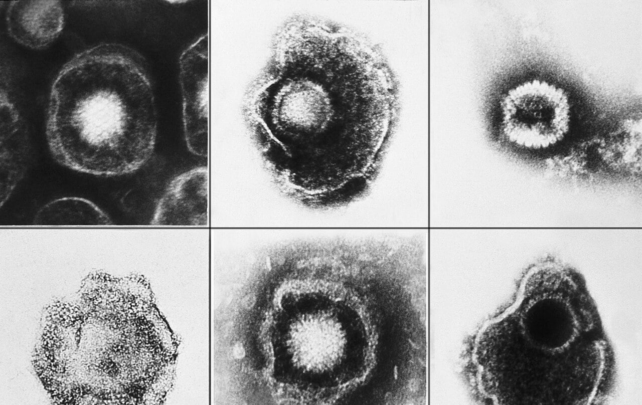 La vacuna que promete ser un escudo contra el infarto y las demencias como el alzhéimer (y tienes en tu centro de salud)