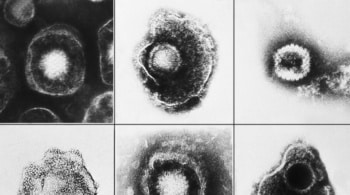 La vacuna contra el infarto y las demencias como el alzhéimer (y tienes en tu centro de salud) 