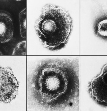 La vacuna que promete ser un escudo contra el infarto y las [...]