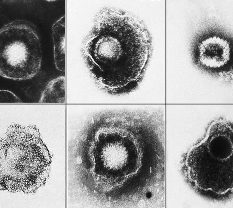 La vacuna que promete ser un escudo contra el infarto y las demencias como el alzhéimer (y tienes en tu centro de salud)