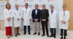 La Comunidad Valenciana lidera los trasplantes cardíacos en España con 689 intervenciones en 2025