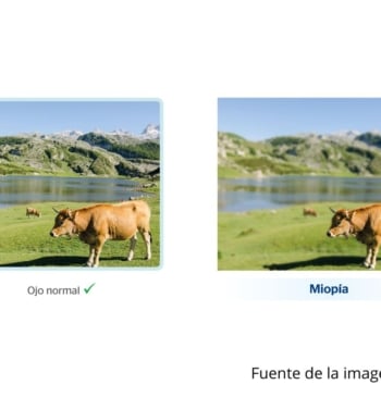 El coste oculto de la miopía: cuánto gastarás en gafas en toda [...]