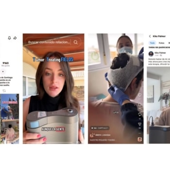 Las redes sociales sacan del silencio al glioblastoma, el tumor cerebral más [...]