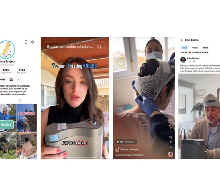 Las redes sociales sacan del silencio al glioblastoma, el tumor cerebral más agresivo