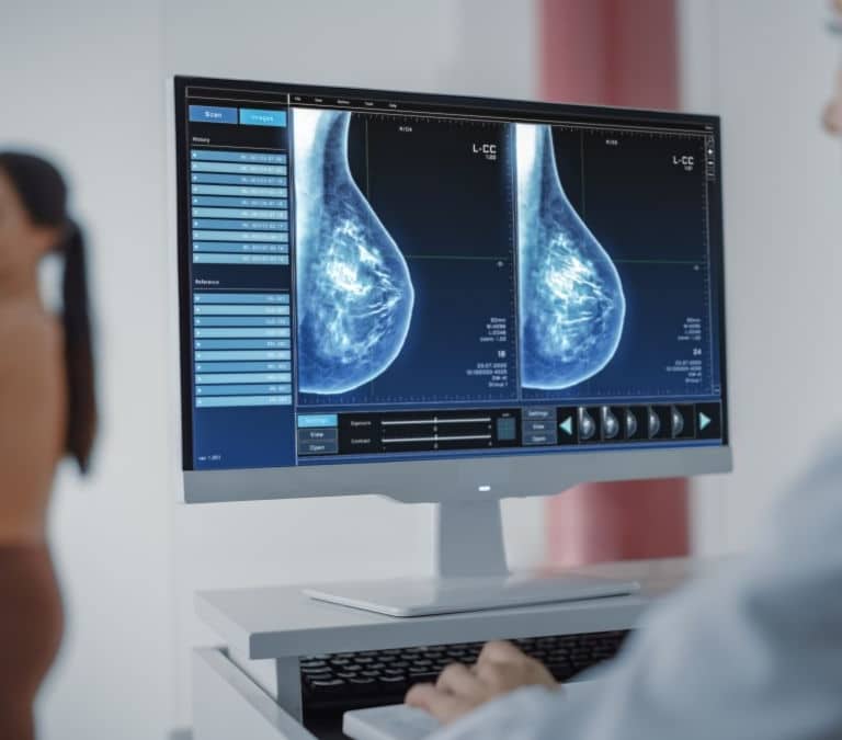 La SECA, la Fundación ECO y Novartis presentan un nuevo modelo asistencial integrado en cáncer de mama precoz