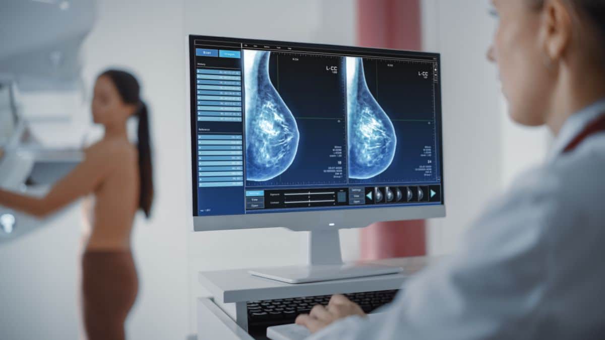 La SECA, la Fundación ECO y Novartis presentan un nuevo modelo asistencial integrado en cáncer de mama precoz