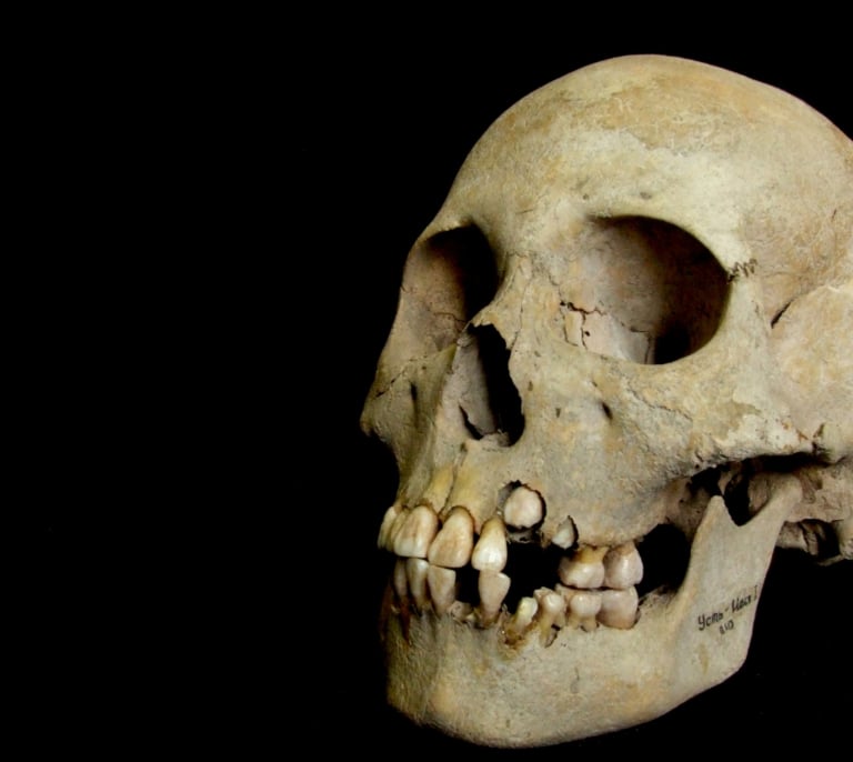 Zoonótica y mortal: restos de ADN demuestran que la primera plaga de peste de la historia tuvo lugar hace 5.500 años