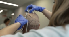 El Hospital público 12 de Octubre participa en un ensayo en Fase 3 que combina campos eléctricos e inmunoterapia frente al glioblastoma