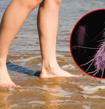 ¿Vas a la playa este verano? Alerta por la bacteria carnívora