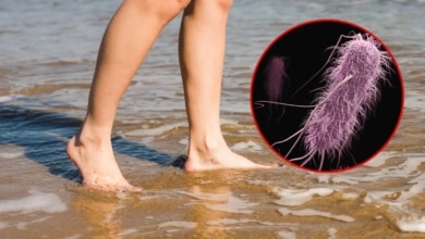 ¿Vas a la playa este verano? Alerta por la bacteria carnívora