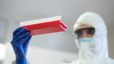 ¿Podría llegar el ébola a España? Lo que se sabe sobre la epidemia más rápida de los últimos años