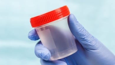 El proyecto Radar logra cribar a casi un millar de personas en Extremadura para frenar el impacto de la enfermedad renal crónica