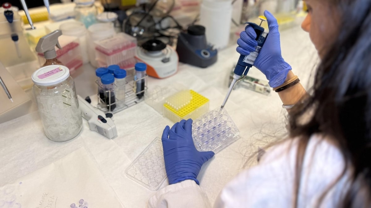 El Hospital La Paz descubre cómo frenar la agresividad del melanoma