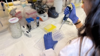 El Hospital La Paz descubre cómo frenar la agresividad del melanoma