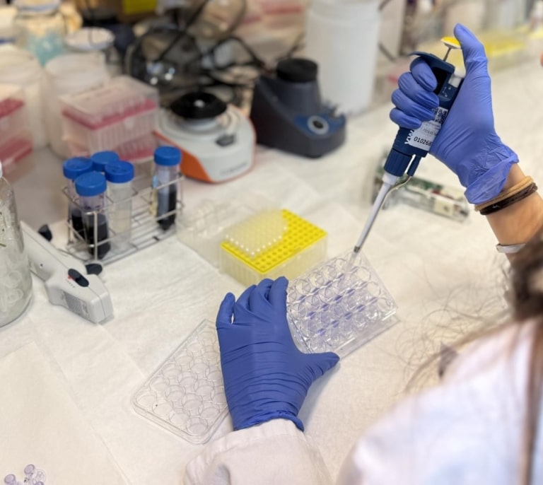 El Hospital La Paz descubre cómo frenar la agresividad del melanoma