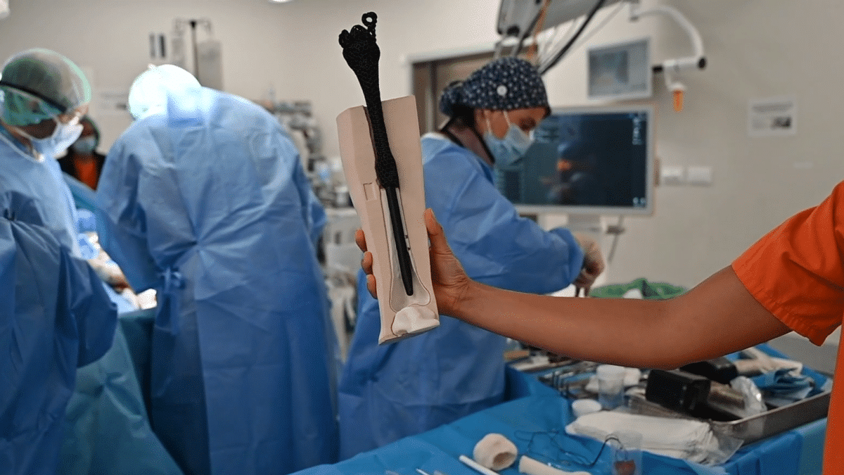 El hospital Gregorio Marañón implanta la primera prótesis ósea de 'metamaterial' del mundo