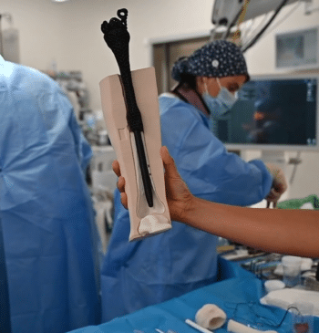 El hospital Gregorio Marañón implanta la primera prótesis ósea de 'metamaterial' del [...]