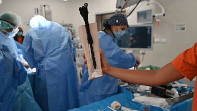 El hospital Gregorio Marañón implanta la primera prótesis ósea de 'metamaterial' del mundo
