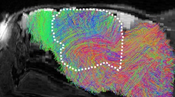 Científicos cultivan tejido cerebral humano en ratones para estudiar trastornos neurológicos