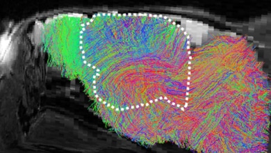 Científicos cultivan tejido cerebral humano en ratones para estudiar trastornos neurológicos