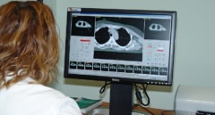 Andalucía destina 6,2 millones a renovar los equipos de medicina nuclear de dos hospitales