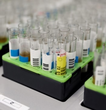 La misteriosa muerte de una trabajadora rusa de un laboratorio hace saltar [...]