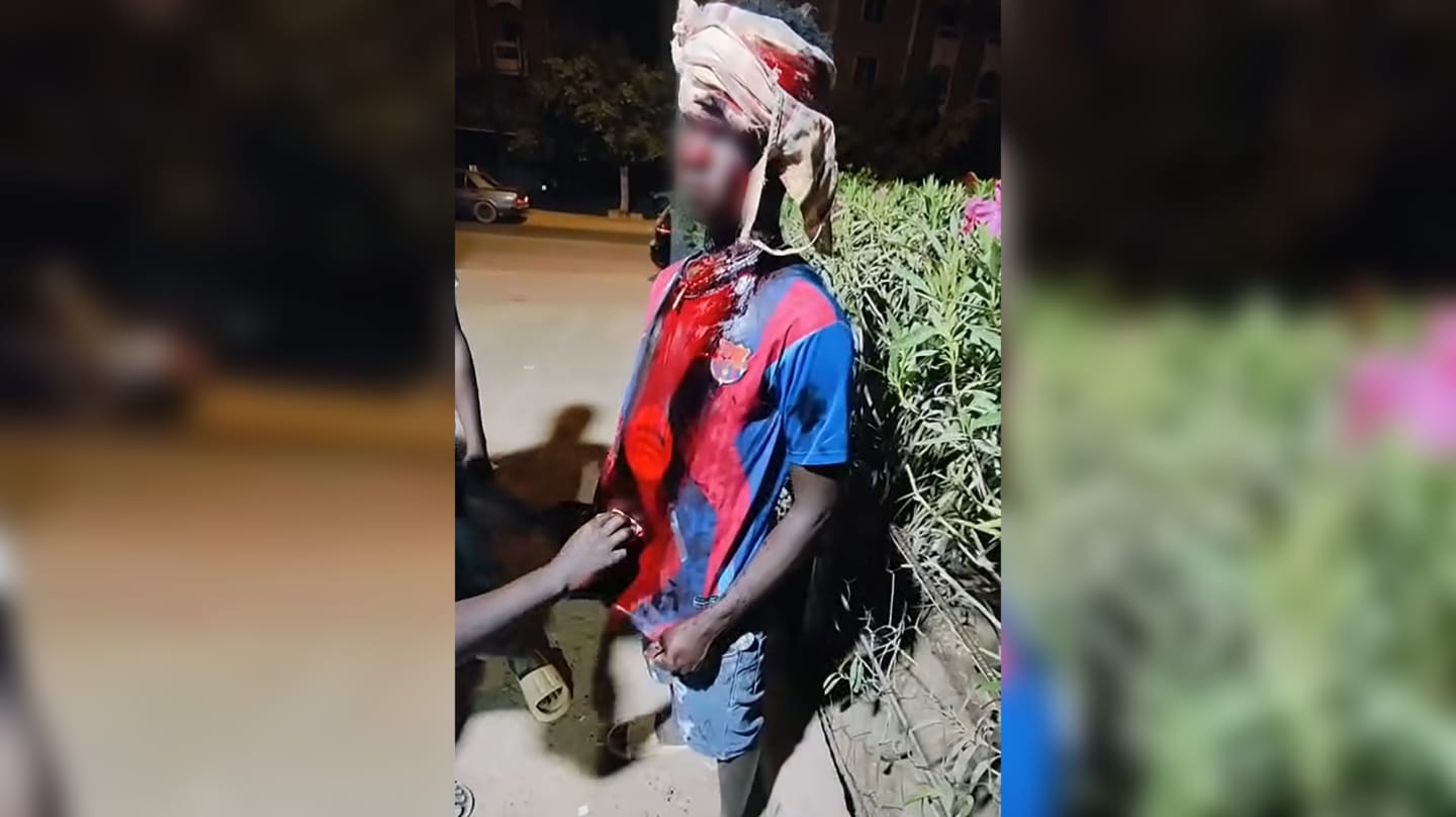 Inmigrante sudanés víctima de una agresión en Marruecos