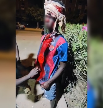 Agresiones, abusos policiales y racismo: así malviven en Marruecos los inmigrantes sudaneses [...]